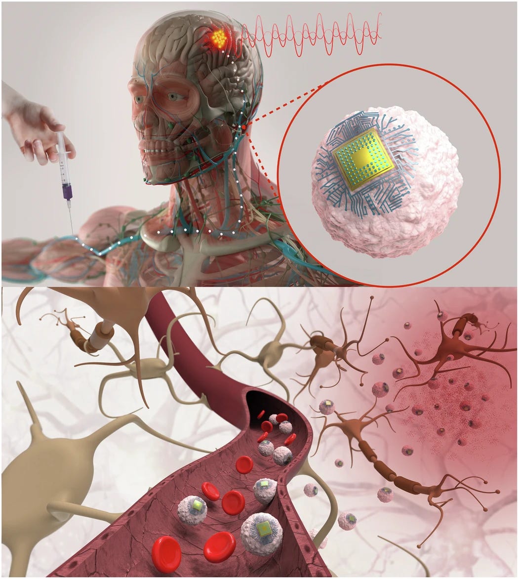 New therapeutic brain implants could defy the need for surgery: MIT ...