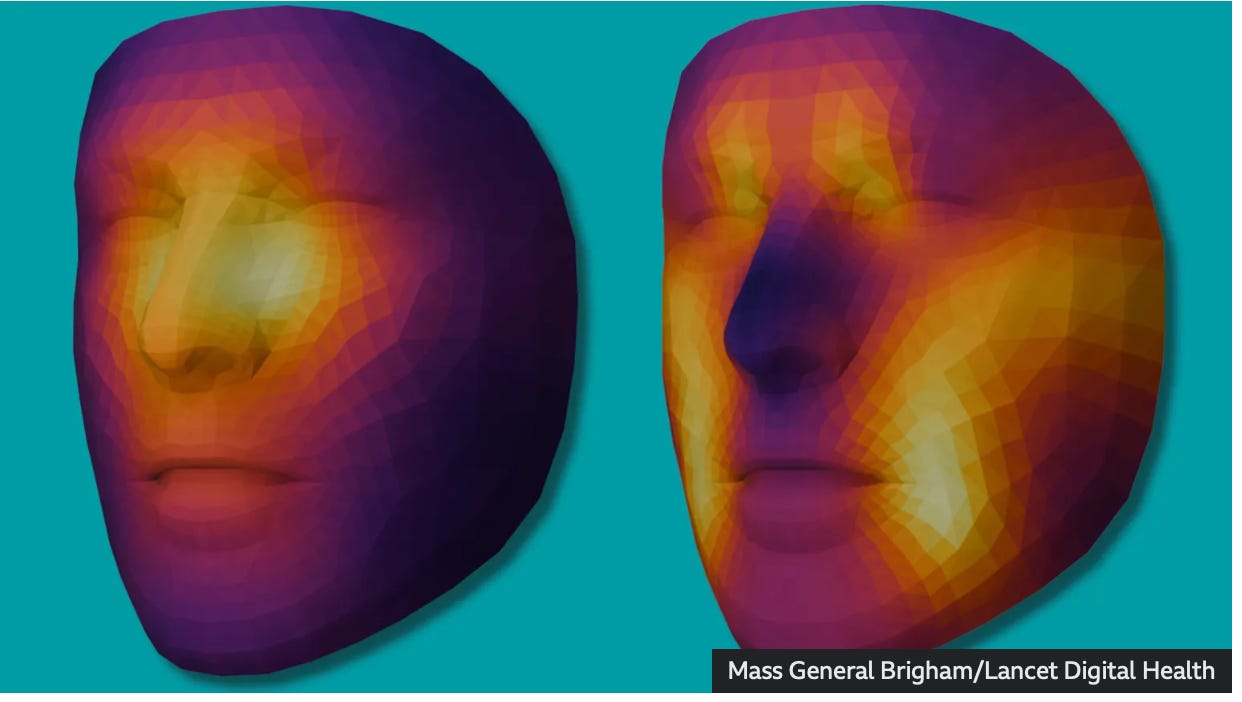 Survivial Example Predicting cancer survival from a single selfie?