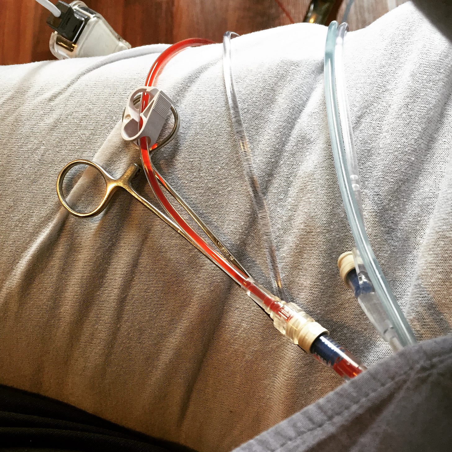 leukemia bone marrow transplant