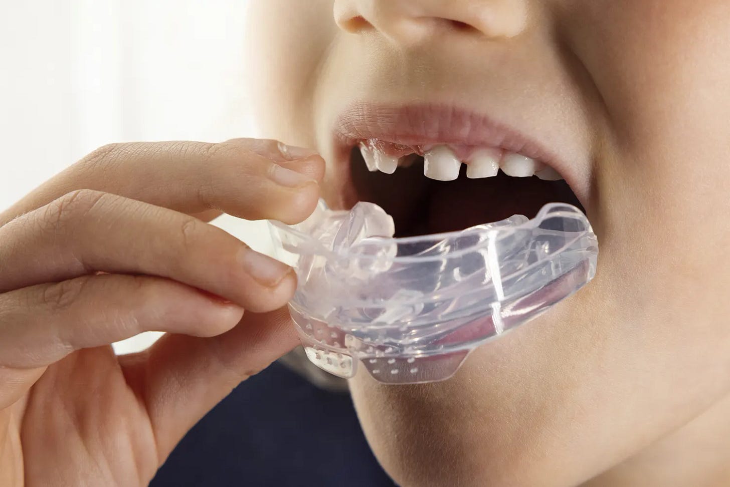 Myobrace for Kids in Helotes | Kinard Family Dental