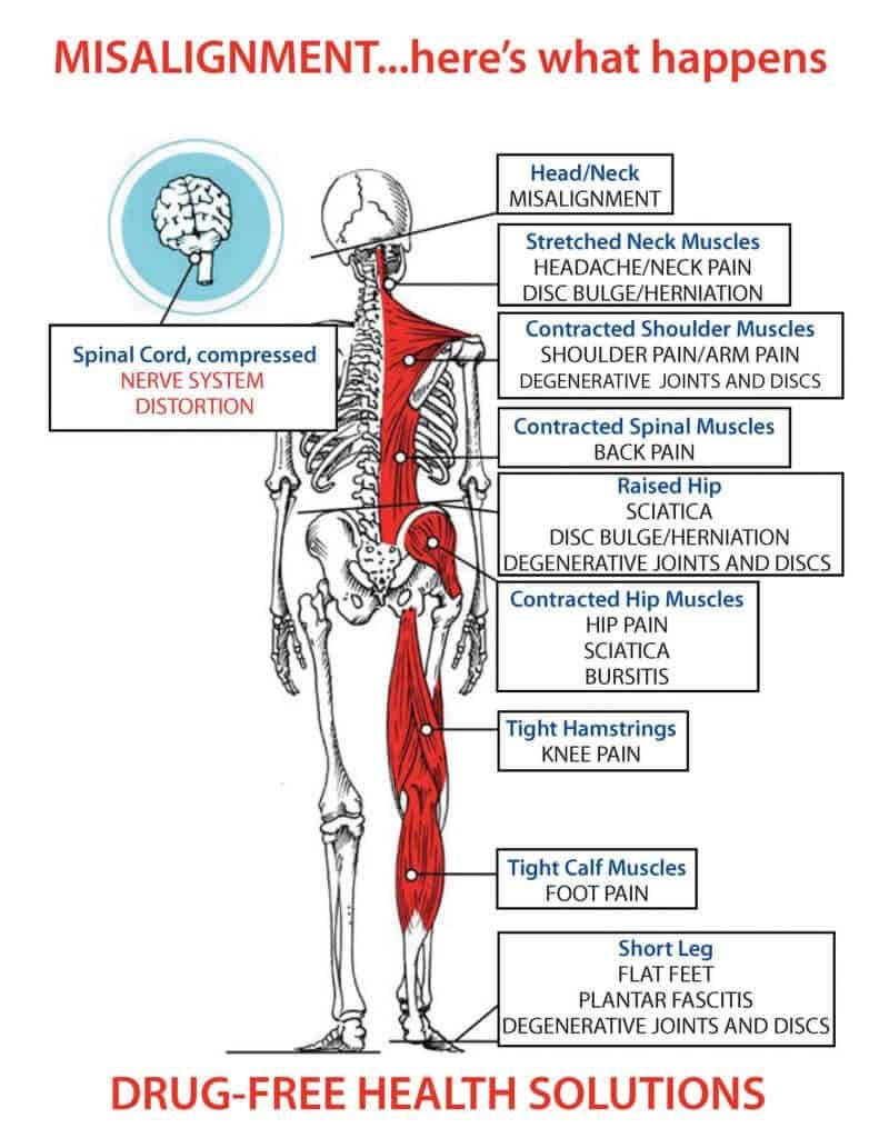 Asheville Upper Cervical Chiropractic - Upper Cervical Care