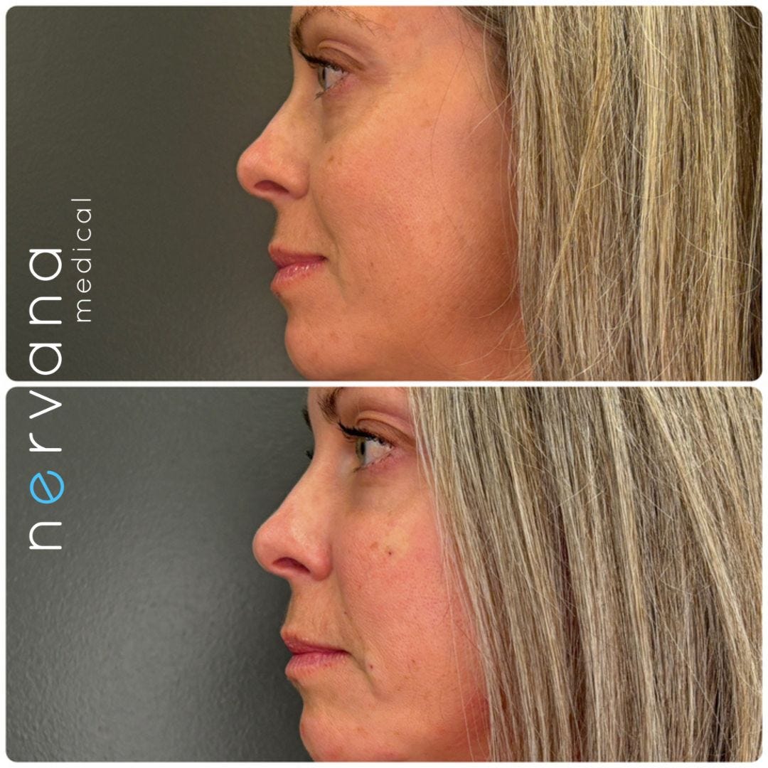 PRF/EZ Gel in Sandy, UT