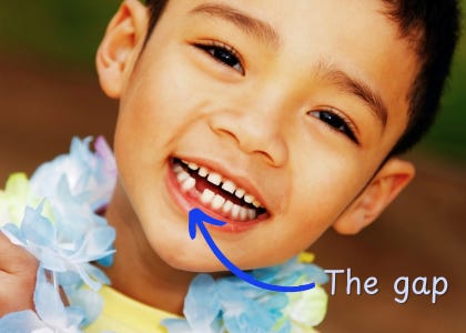 A smiling child wearing a lei with a missing tooth.