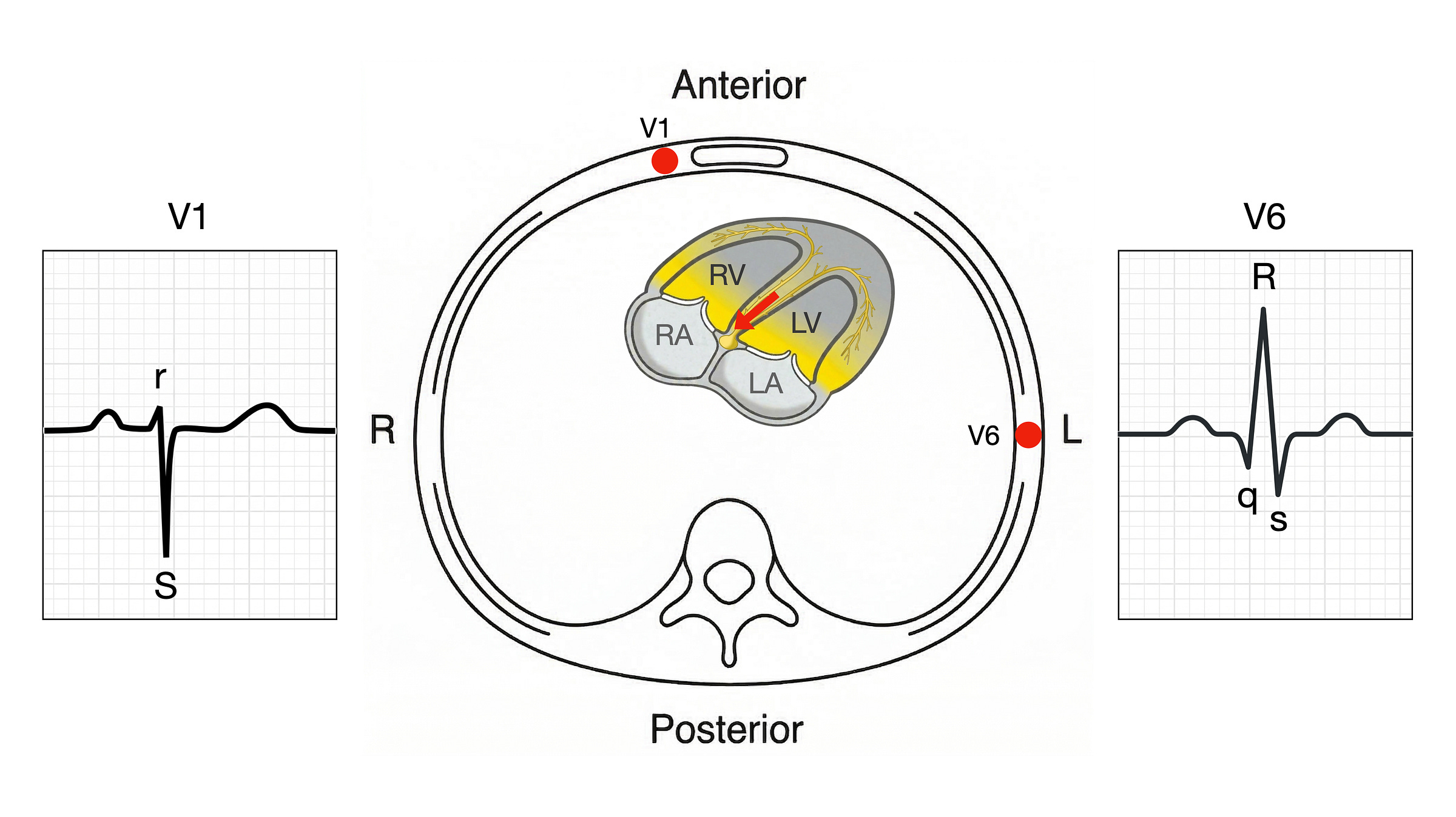 normal-ventricular-depolarisation-3