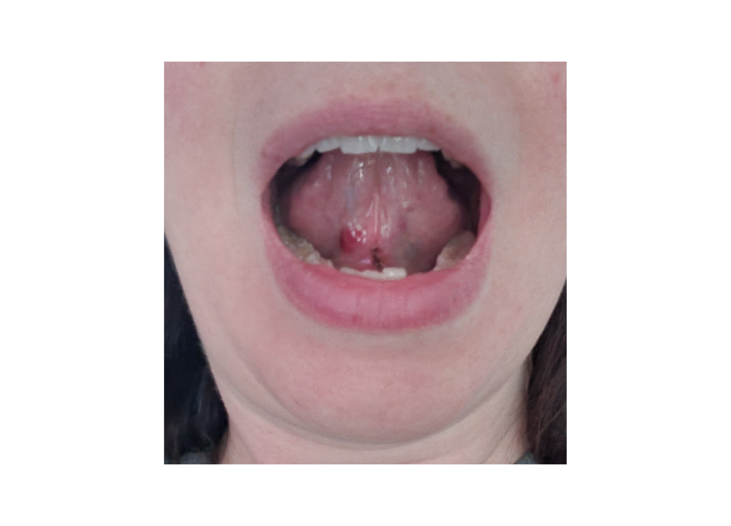 Tongue-tied\, image size:1456x1048