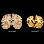 The North Star with Shaun King