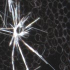 Magnetic field vortices and blood count changes
