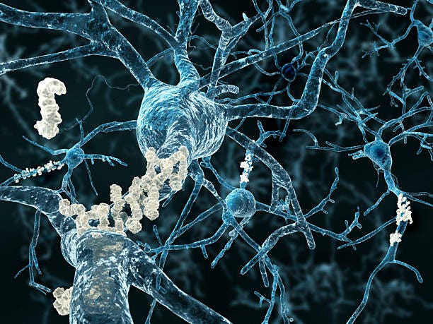 570+ Amyloid Stock Photos, Pictures & Royalty-Free Images - iStock | Amyloid  plaques, Amyloid protein, Amyloid beta