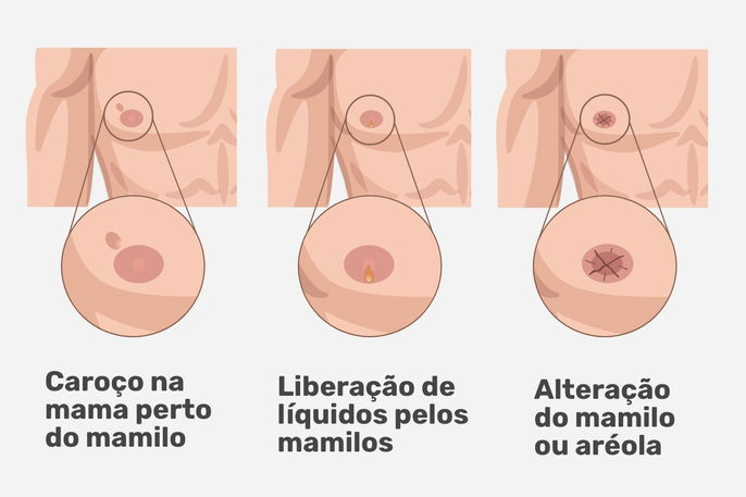 Imagem ilustrativa número 2