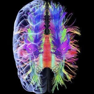 A Pinterest pin added by voronlosk on Dec 23, 2024. The author is voronlosk. May present: brain scan art, neuroimaging, brain, white matter, diffusion-weighted magnetic resonance imaging. A Pinterest pin added by voronlosk on Dec 23, 2024. The author is voronlosk. May present: brain scan art, neuroimaging, brain, white matter, diffusion-weighted magnetic resonance imaging.