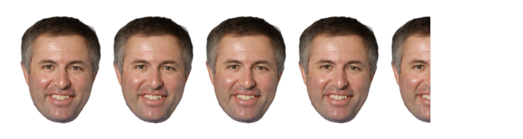 4.5 images of Dr. Boulton's head