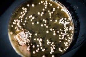 Bacteria in a dish