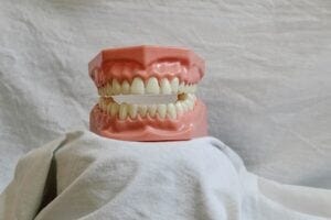 dentures on a pedestal