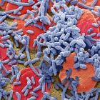 MIS-C, Sepsis and the puzzle between