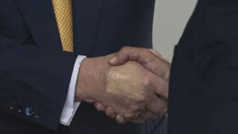 Getty Images Bruising is seen on President Donald Trump's hand while shaking the hand of Crown Prince and Prime Minister of the Kingdom of Bahrain Salman bin Hamad bin Isa Al Khalifa at the White House 16 July, 2025. Getty Images Bruising is seen on President Donald Trump's hand while shaking the hand of Crown Prince and Prime Minister of the Kingdom of Bahrain Salman bin Hamad bin Isa Al Khalifa at the White House 16 July, 2025.