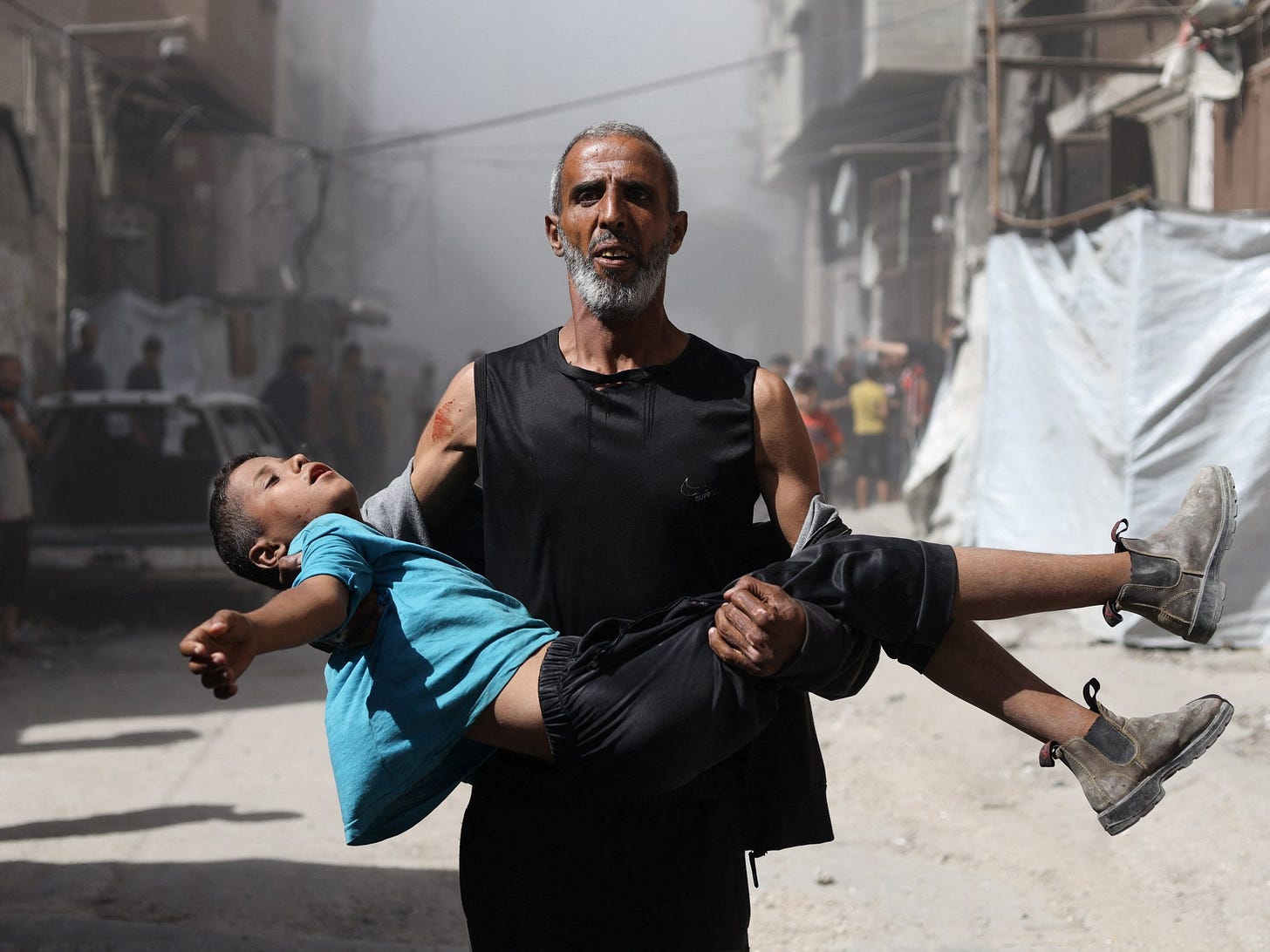 Foreign doctors say Israel systematically targeting Gaza’s children: Report Foreign doctors say Israel systematically targeting Gaza’s children: Report