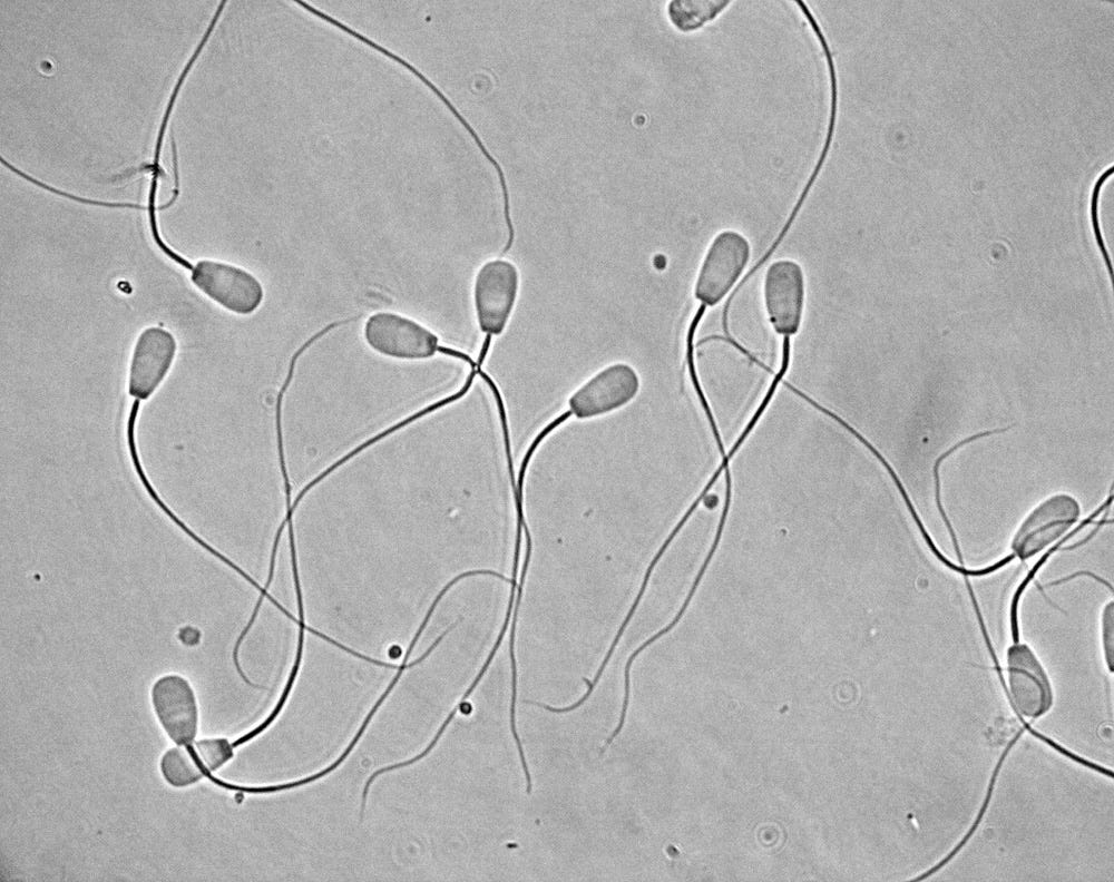 Bull Sperm Morphology