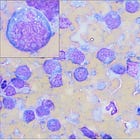 Five-Minute Paper: Canine Granular Lymphoma 
