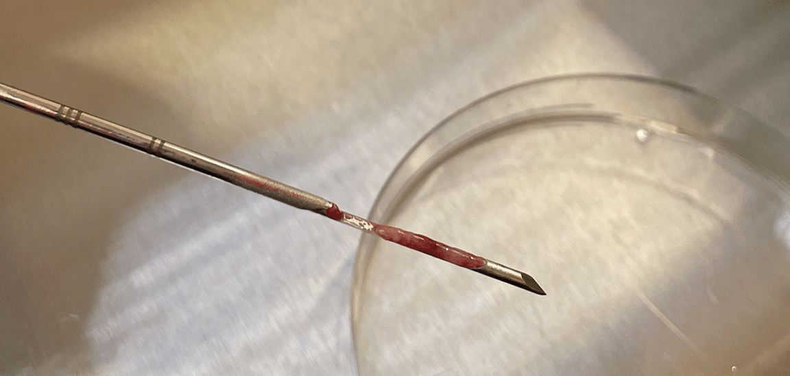 Biopsy of Skin and Subcutaneous Tumors in Veterinary Medicine Biopsy of Skin and Subcutaneous Tumors in Veterinary Medicine
