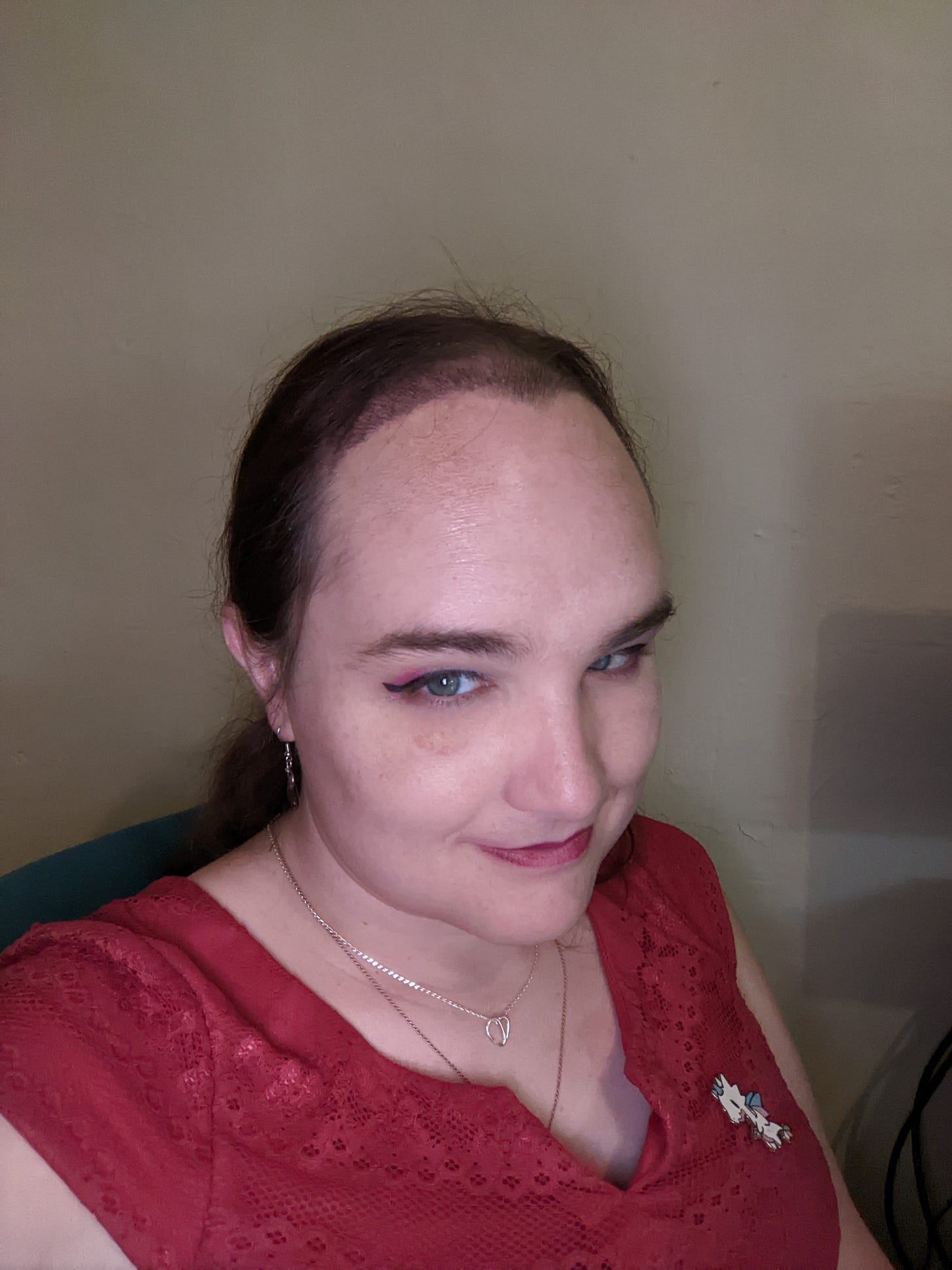 A picture of DOc Impossible. Her face is still swollen, and the hair transplants are still very visible.