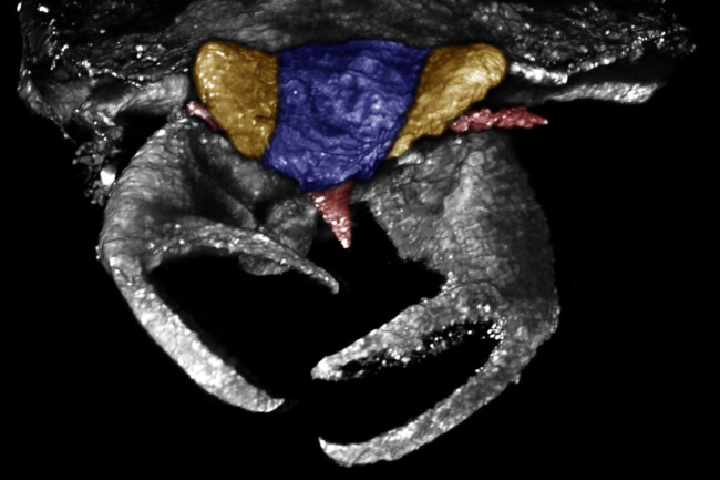 La punaise, vue de face et de près grâce au scanner, avec ses énormes pinces en gros plan (chaque pince est aussi grosse que sa tête) La punaise, vue de face et de près grâce au scanner, avec ses énormes pinces en gros plan (chaque pince est aussi grosse que sa tête)