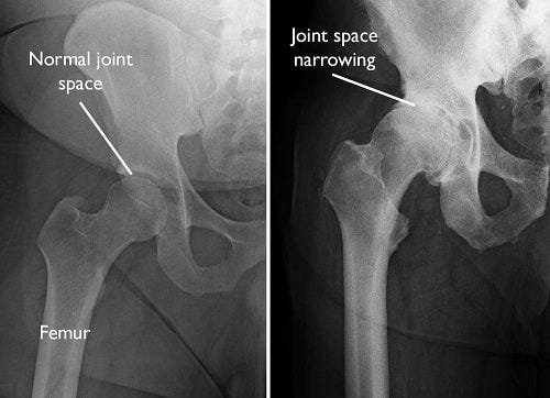Joint Dissociation: A Trainable Element of Joint Function (Point B)