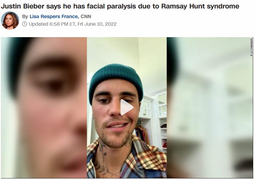 Why I'm 99% certain that Justin Bieber's facial paralysis was caused by the COVID vaccine