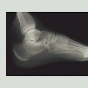 The Nurse Told Me I Had Gout. Then I Sent Feet Pics to ChatGPT.