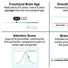 Transforming Brain Health Through Lifestyle Changes
