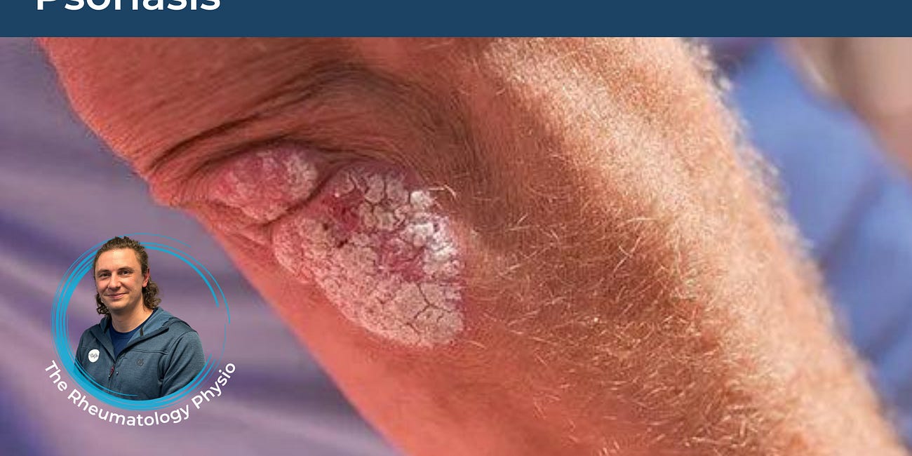 Psoriasis