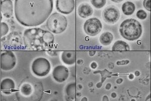 Image shows four common forms of Blastocystis hominis - vacuolar, granular, amoeboid, and cyst forms. Image created by Valentia Lim Zhining on May 14th, 2006.