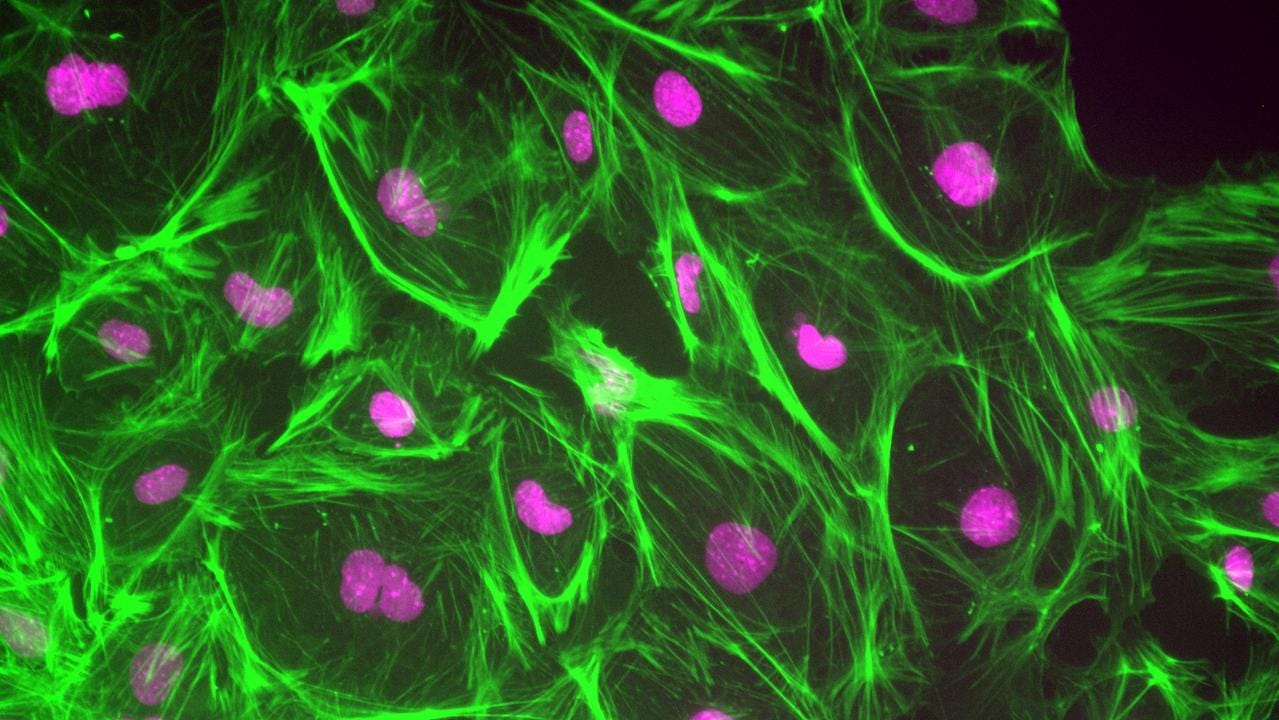 Do stem cells grow better in space? | KidsNews