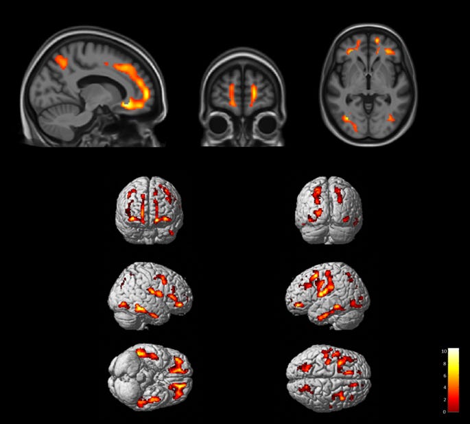 figure 1 figure 1
