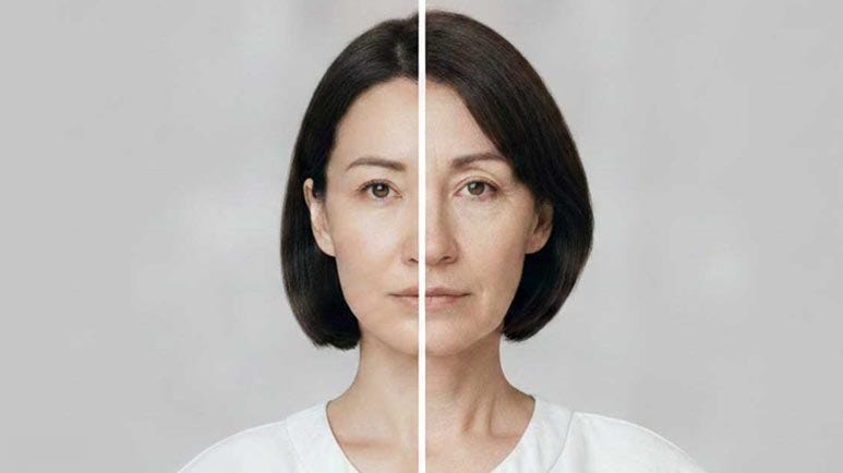 ozempic face causes and prevention ozempic face causes and prevention