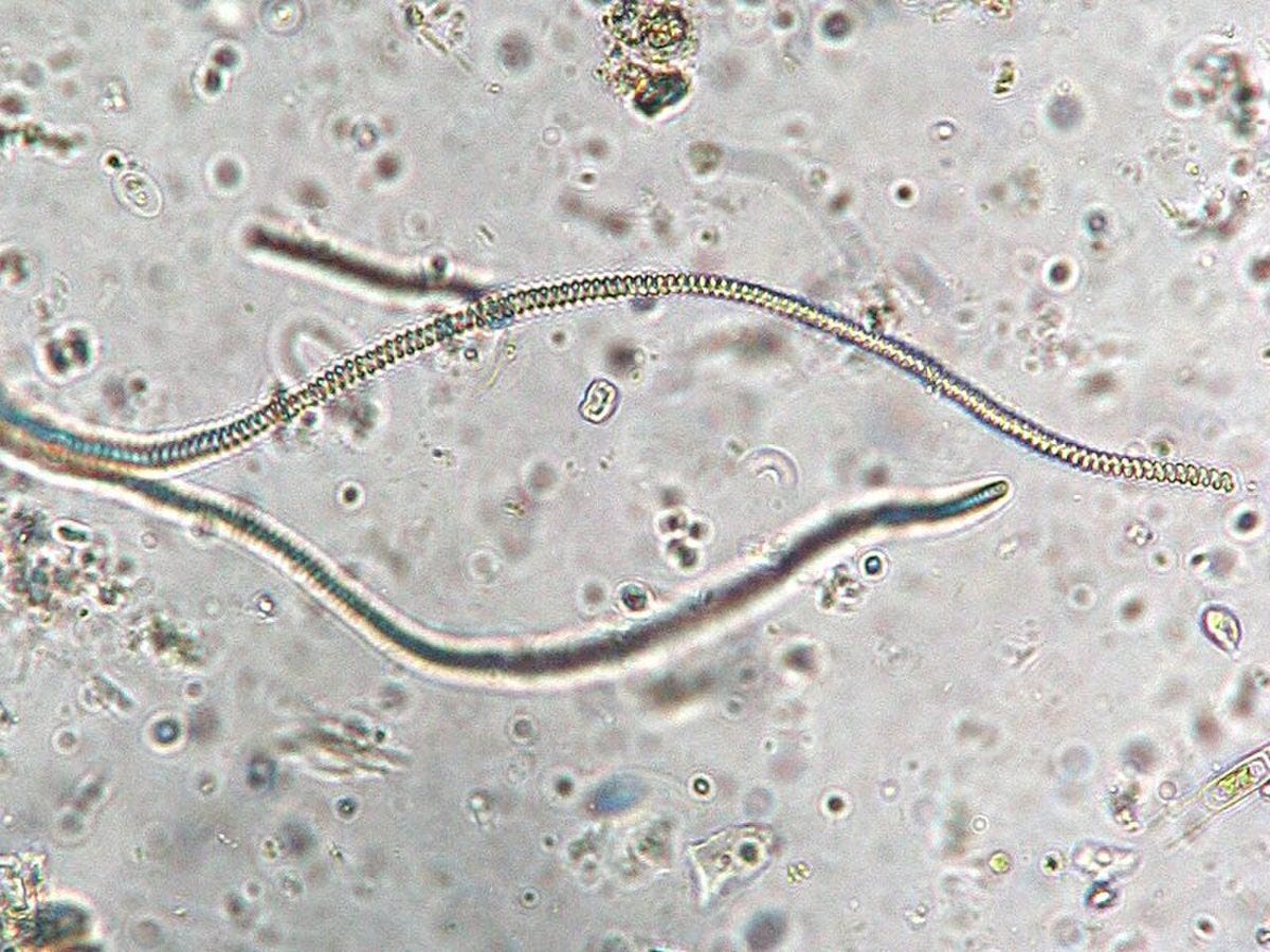 Spiral filaments of a cyanobacterium under a microscope