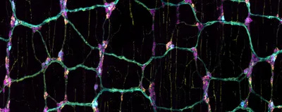 A digitally stitched image of nutrient-sensing neurons (cyan) in the mouse gut, highlighting a subset of inhibitory nerve cells (yellow).