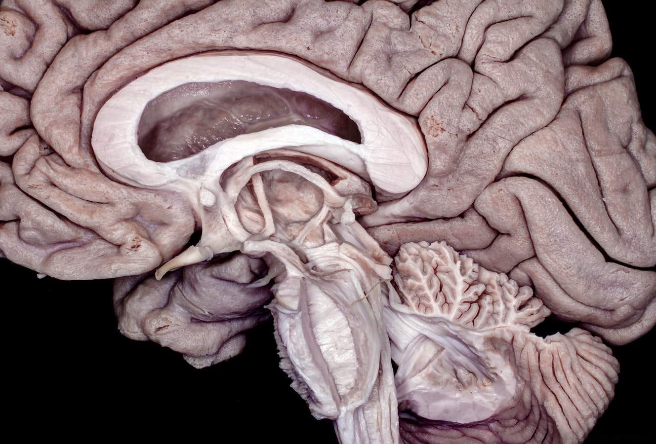 Neuroanatomy Brain Model , Stroke Model - DUCY Neuroanatomy Brain Model , Stroke Model - DUCY