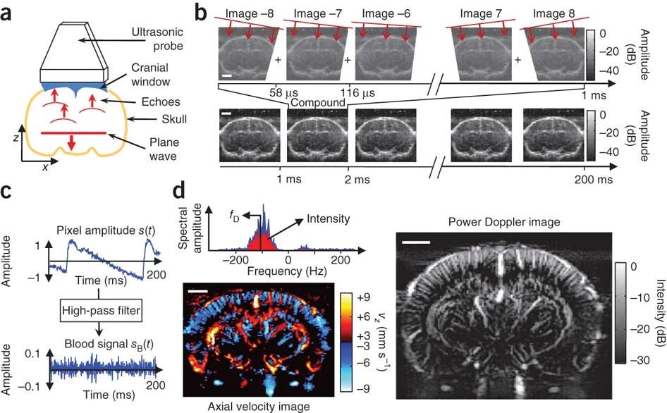 Functional ultrasound imaging, as first demonstrated by Macé et al. (2011). An ultrasonic probe is used to image a rat’s brain very rapidly. A computational approach isolates rapidly changing pixels, forming a map of the vasculature. Functional ultrasound imaging, as first demonstrated by Macé et al. (2011). An ultrasonic probe is used to image a rat’s brain very rapidly. A computational approach isolates rapidly changing pixels, forming a map of the vasculature.