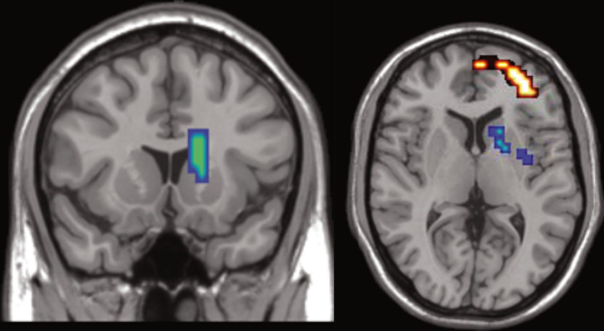 The Neuroscience of Weed - by Nellie Jun - psychedelirium