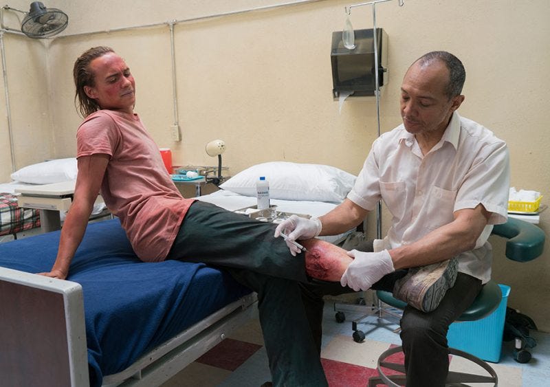 nick dog bite heals on fear the walking dead nick dog bite heals on fear the walking dead