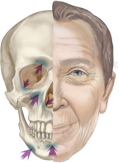 harmonização facial, envelhecimento