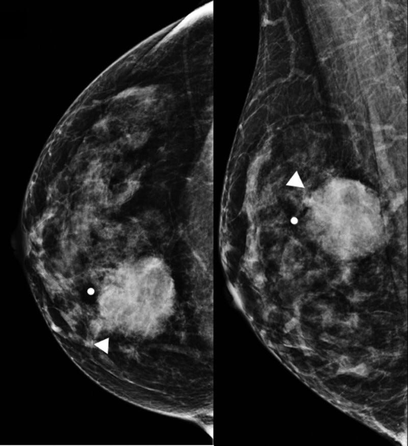 Figure 1. Figure 1.
