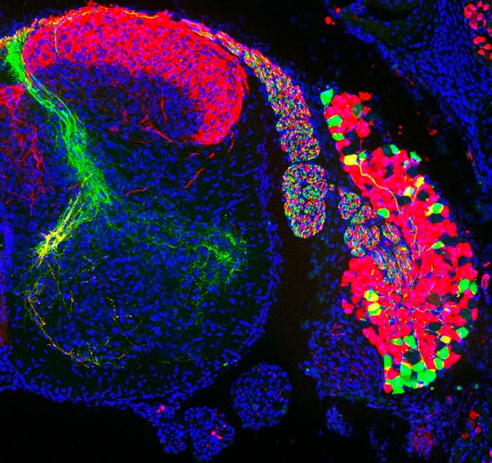 Different populations of sensory neurons cell bodies in a dorsal root ganglion (right) and their axons in the spinal cord (left): The cells in green detect proprioceptive information while the cells in red thermal and tactile information.