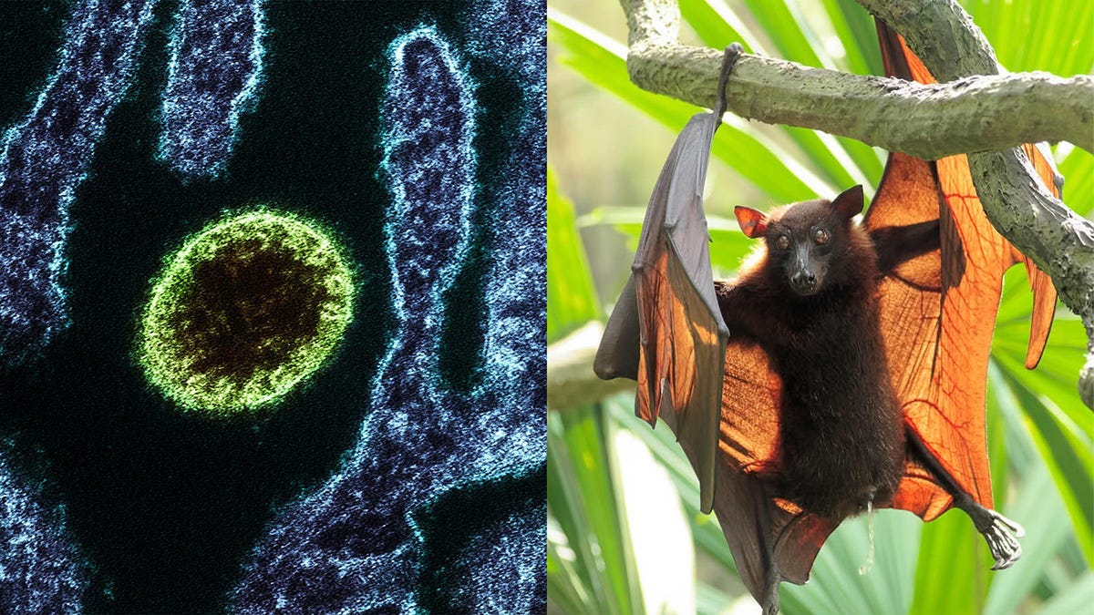 Nipah virus: What nurses need to know | National Nurses United
