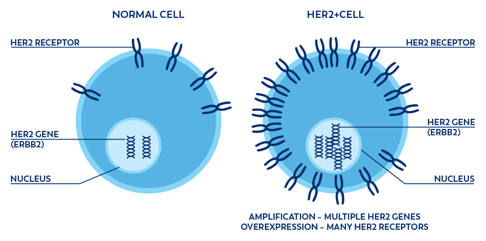 HER2 Biomarker in Colon Cancer | Know Your Biomarker