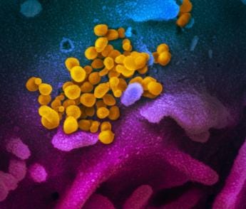 Scanning electron microscope image showing SARS-CoV-2 emerging from the surface of cells