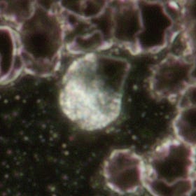 History of a self-replicating structure in the blood