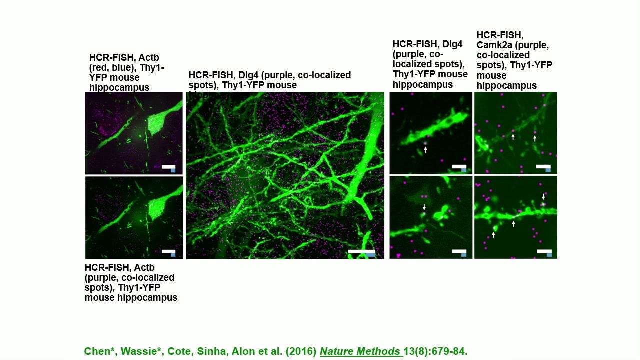 Ed Boyden: Neurophotonic strategies for observing and controlling neural  circuits - YouTube