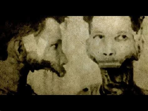 Radithor, Prescribed To Eben Byers By Quack Doctor Until His Jaw Fell Off! - YouTube Radithor, Prescribed To Eben Byers By Quack Doctor Until His Jaw Fell Off! - YouTube