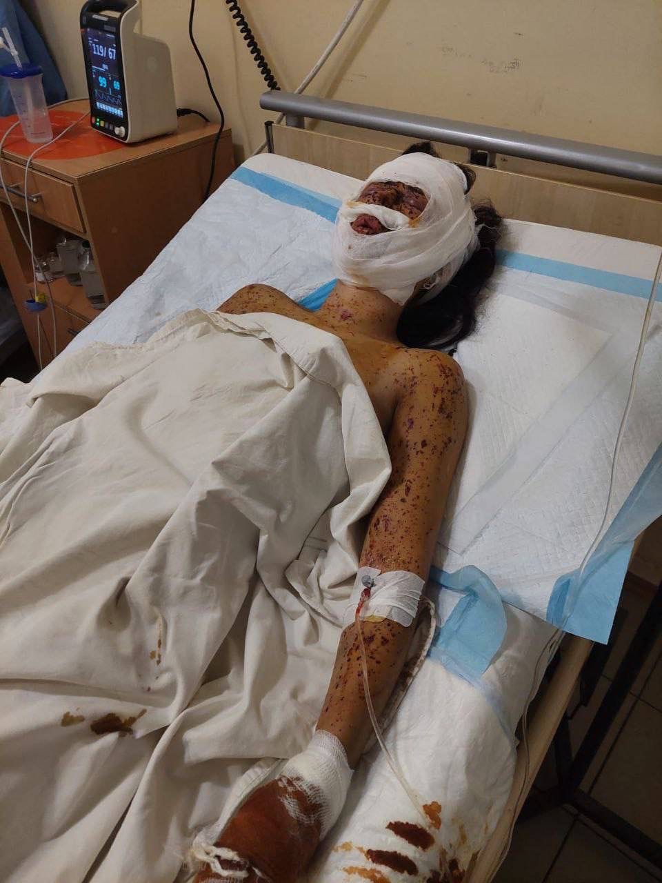 Plastic surgery to cover up war wounds